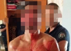 Кровавую расправу над своим пенисом совершил наркоман из Тирасполя