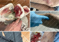 В Кишиневе стая бродячих собак напала на девушку