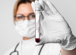 Коронавирус в Молдове: в пятницу подтвердилось еще 568 новых случаев COVID-19 