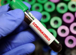 В Молдове + 1042 новых случая COVID-19 