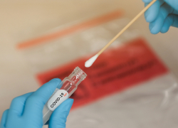 В Молдове выявлено 544 новых случая заражения COVID-19 