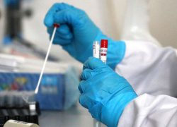 В Молдове выявлено 560 новых случаев COVID-19  