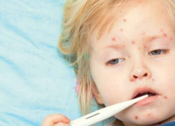 Корь бушует на севере Молдовы, сохраняется желтый код опасности эпидемии