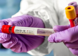 В Молдове выявлено 293 новых случая COVID-19 за сутки 