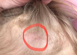 В зоопарке Бардара конь укусил девочку за голову