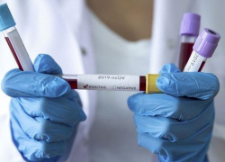 В Молдове 239 новых случаев COVID-19 – данные Минздрава за четверг 