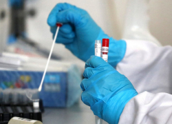 В последний день марта в Молдове выявлено 315 новых случаев COVID-19 