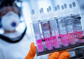 В Молдове выявлено 1039 новых случаев COVID-19