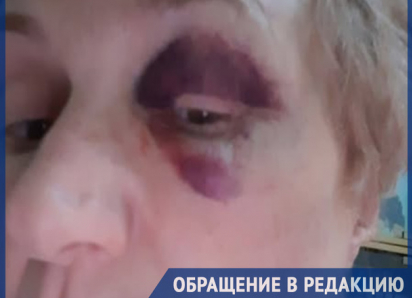 Женщину избили среди бела дня на одной из столичных улиц