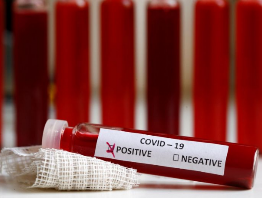 В Бельцкой больнице два врача заразились коронавирусом