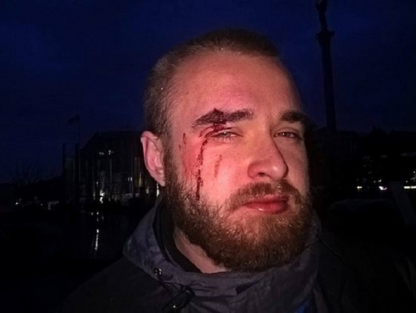 Кровавое избиение вернувшегося из Донбасса военнослужащего совершили торговцы в Киеве