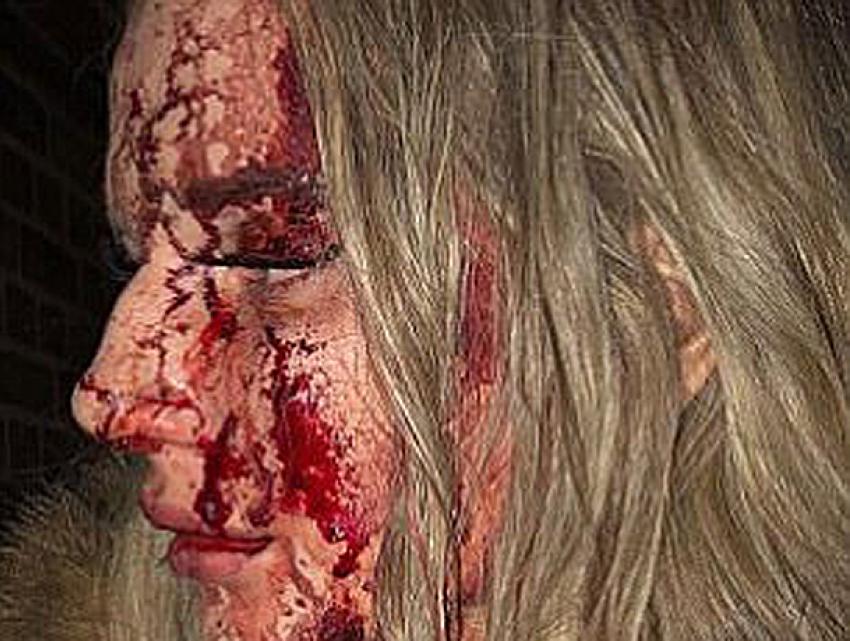 Кровавое избиение сексуальной блондинки совершил пытавшийся пощупать ее ягодицы мужчина в ночном клубе 