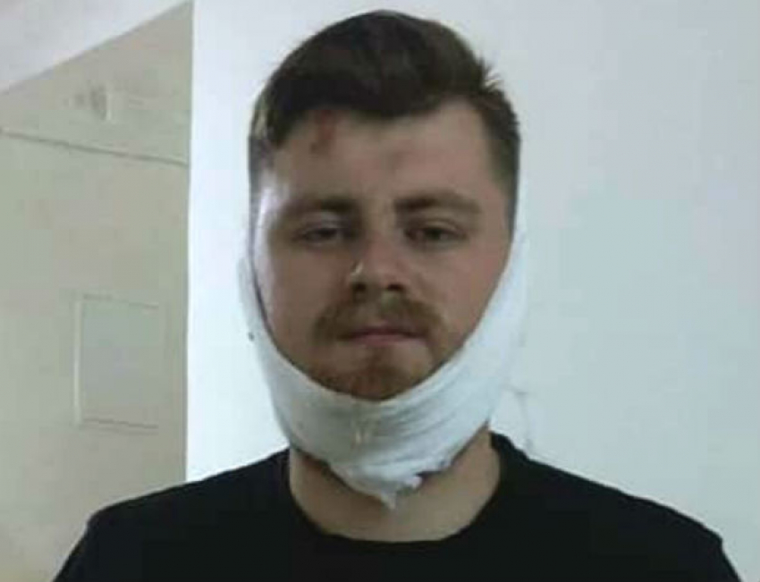 Драма абсурда: националисты сломали челюсть воевавшему в Донбассе за крик «Слава Украине!»