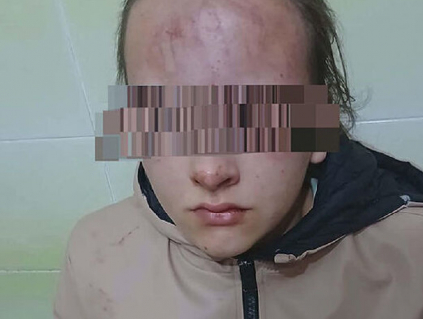 Минобразования отреагировало на резонансное нападение на школьницу