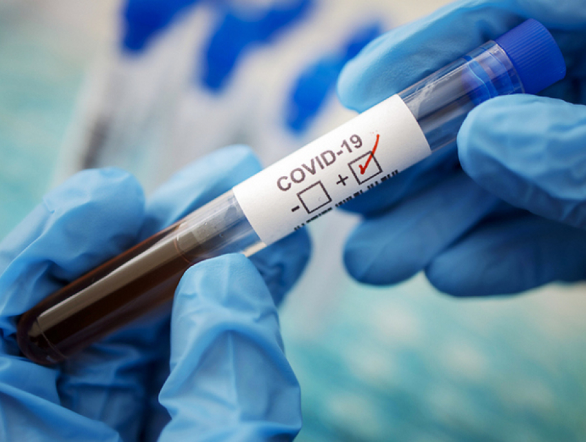 В Молдове +954 новых случая COVID-19 за сутки