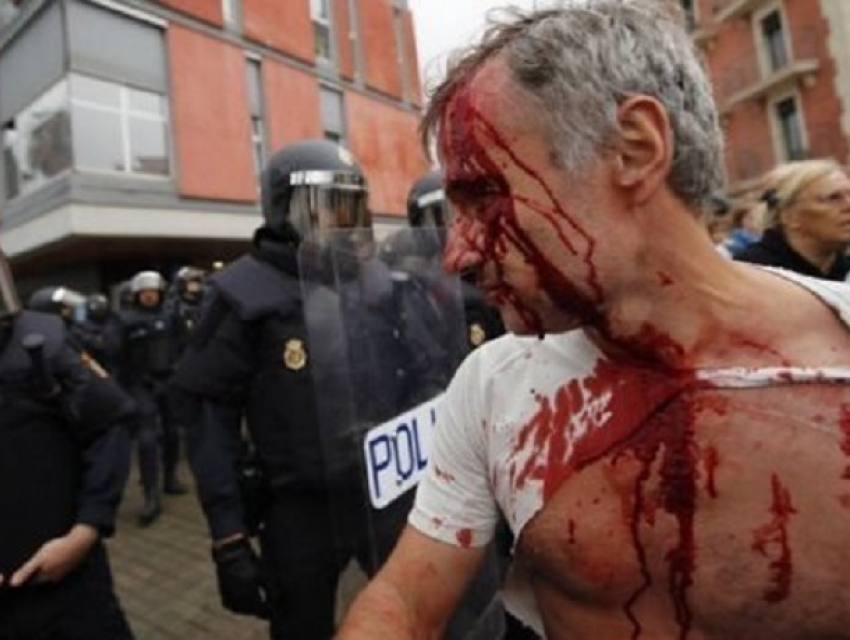 Кровавые избиения женщин и детей во время референдума в Каталонии сняли на видео