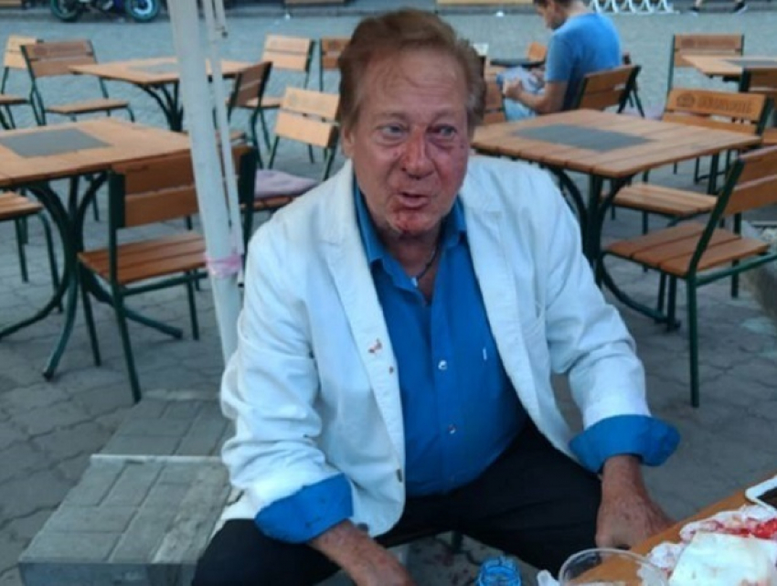Кровавое избиение знаменитого друга Фрэнка Синатры совершил мужчина в Одессе