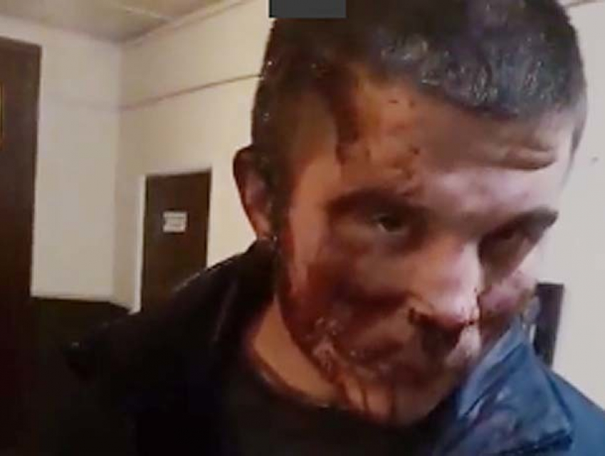 Жуткие кадры избиения сына в отделе полиции Шолданешт опубликовала его мать