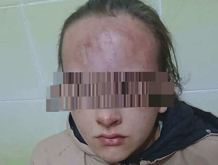 Избиение школьницы в Яловенском районе: виновным грозит реальный срок