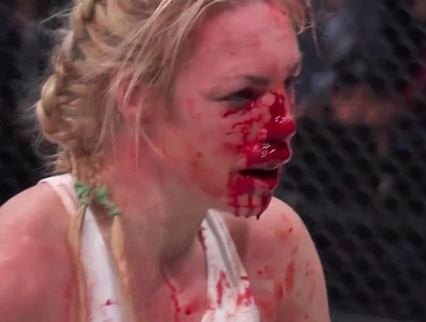 "Кровавое месиво": ужасную травму блондинки сняли на видео
