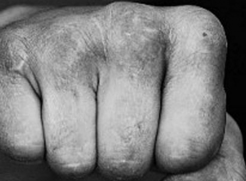 18+ «Дай палку, я ее убью!» - в Бачой подростки жестоко избили девушку