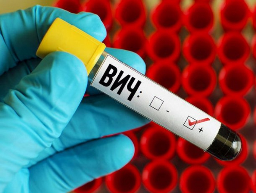В Приднестровье отмечен рост заболеваемости ВИЧ-инфекцией среди сельского населения 