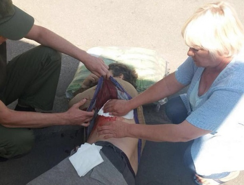 Кровавый пляж: отдыхающий у моря в Одессе мужчина получил тяжелое ранение в живот