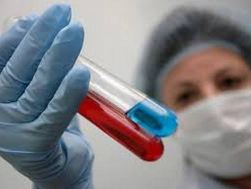 Первая жертва свиного гриппа в Кишиневе: от осложнений в больнице скончалась женщина 