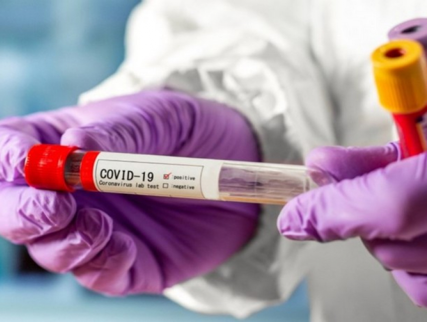 В Молдове выявлено 668 новых случаев COVID-19