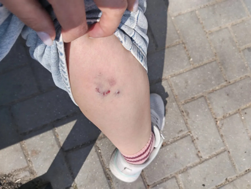 Нападение стаи бродячих собак в Вадул-луй-Водэ: женщина с ребенком теперь проходит вакцинацию