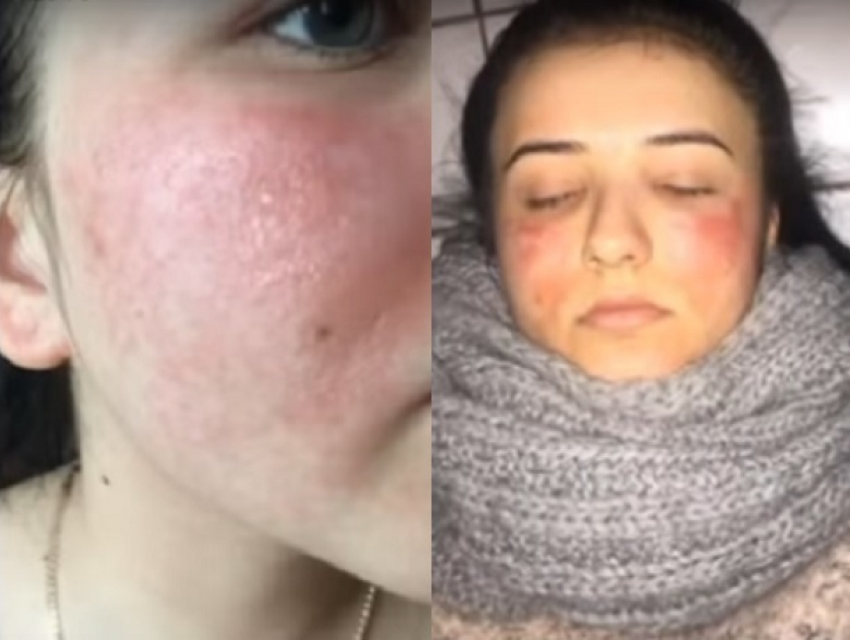 Украинские косметологи превратили девушку в неузнаваемое чудовище