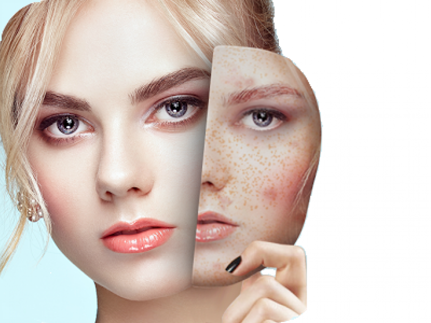 Как улучшить состояние кожи: рекомендации косметолога