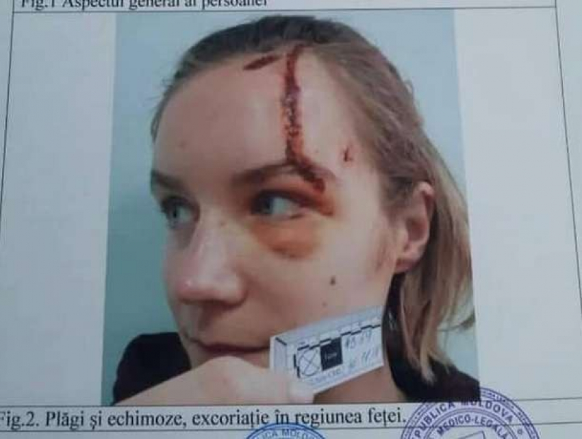 Пострадавшая в ДТП в такси девушка обратилась в суд