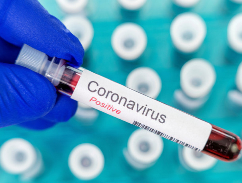 В понедельник в Молдове подтвердилось 352 новых случая COVID-19