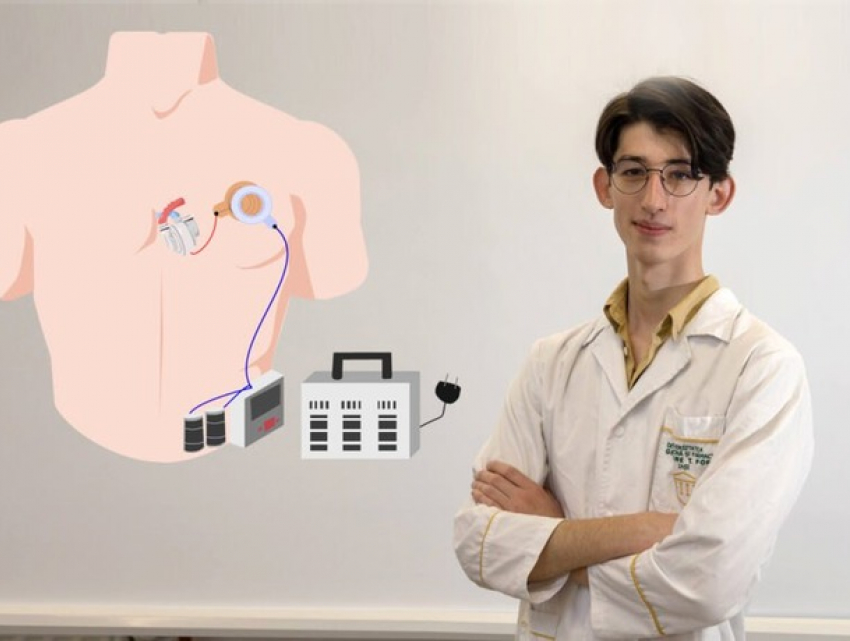 Студент-медик из Сорок вместе с командой из Ясс создал искусственное сердце