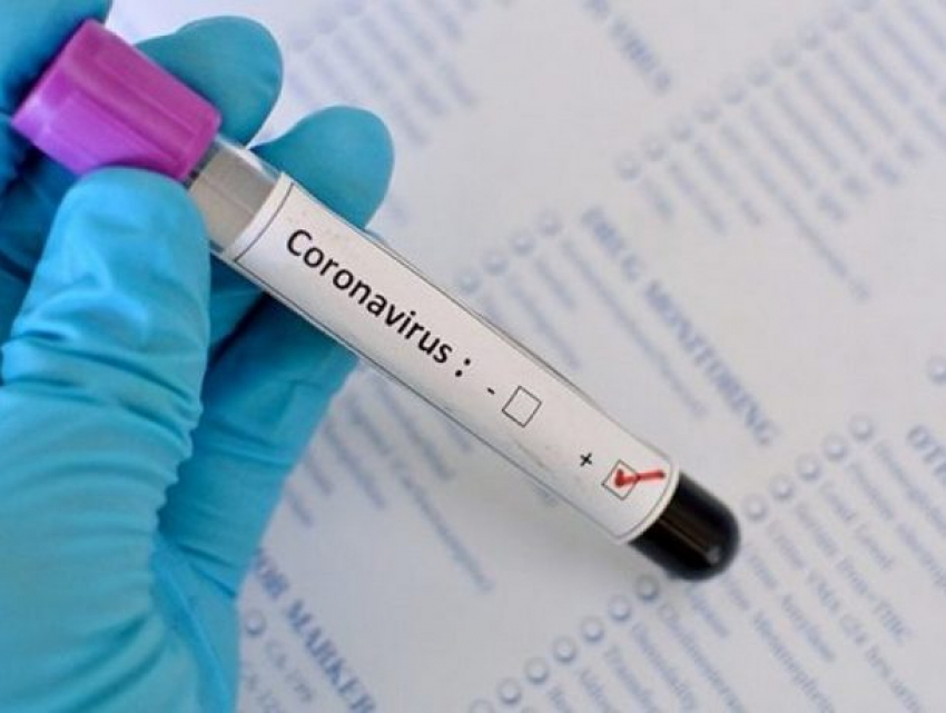 Количество новых случаев заражения коронавирусом в Молдове продолжает сокращаться