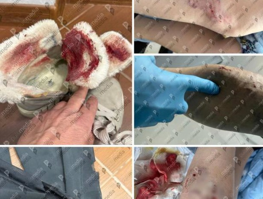В Кишиневе стая бродячих собак напала на девушку