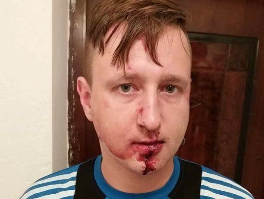 Кровавую расправу над журналистом телеканала совершили трое бандитов на улице в Одессе