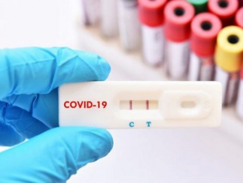 В Молдову поступят еще 100 тысяч экспресс-тестов на коронавирус 